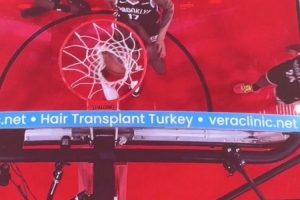 問(wèn)啥詹姆斯！NBA籃板上沿有土耳其植發(fā)公司廣告 手動(dòng)@杰倫-布朗